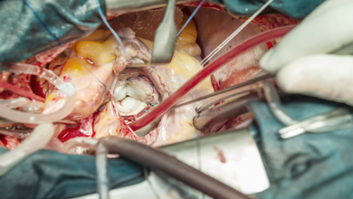 Antithrombotic Therapy After Transcatheter Aortic Valve Implantation
