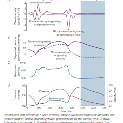 Figure 1 ADVISE Study 2012 Identification of Wave-Free Period in the Cardiac Cycle