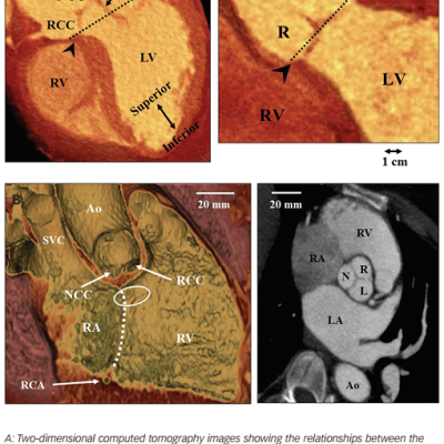 Figure-1-Computed-tomography-images-exhibiting-the-Anatomy