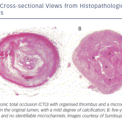 Cross-Sectional Views From Histopathological Specimens