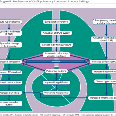 Figure 1 Pathogenetic Mechanisms of Cardiopulmonary Continuum in Acute Settings