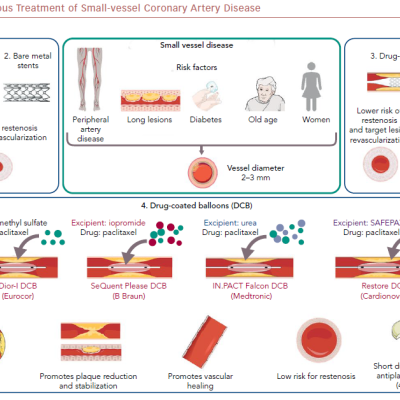 Percutaneous Treatment Of Small-Vessel Coronary Artery Disease