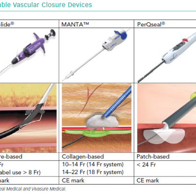 Commercially Available Vascular Closure Devices