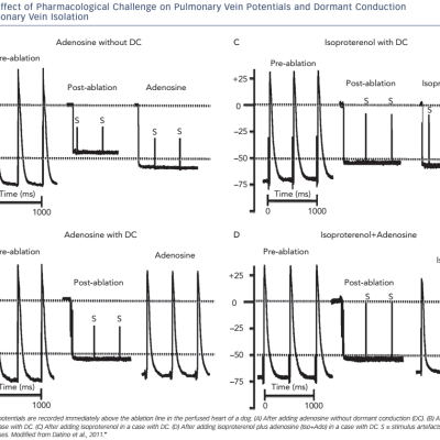 Effect of Pharmacolpgical Challenge