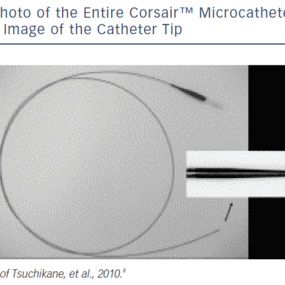 Photo Of The Entire Corsair™ Microcatheter