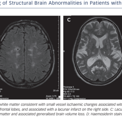 Figure-3-Magnetic-resonance-imaging-of-structural-brain