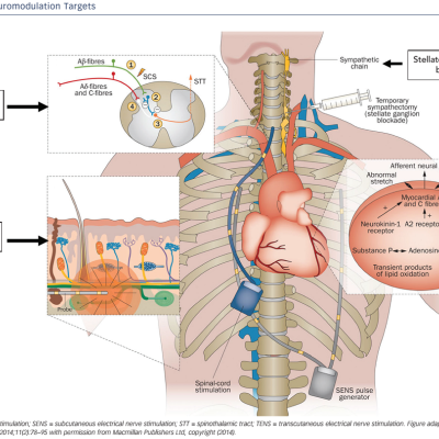 Figure 3 Neuromodulation Targets