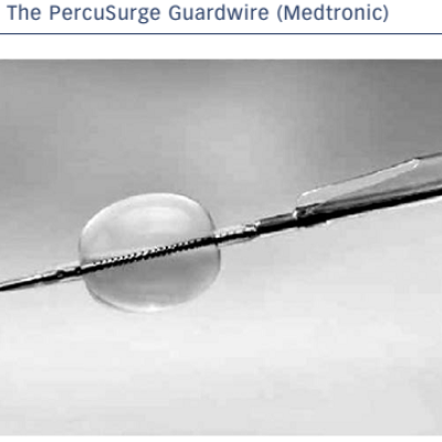 Figure 3 The PercuSurge Guardwire