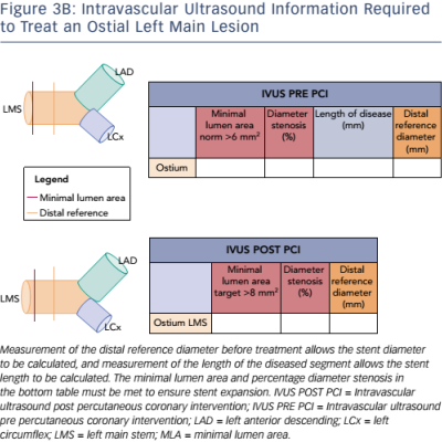 Figure 3B Intravascular Ultrasound Information Required to Treat an Ostial Left Main Lesion