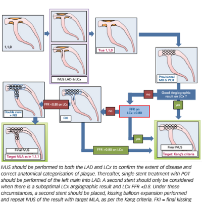 Figure 4 Intended Treatment Regimen for a 110 Left Main Bifurcation