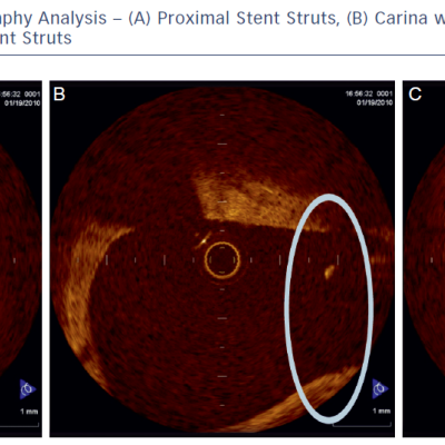 Optical Coherence Tomography Analysis