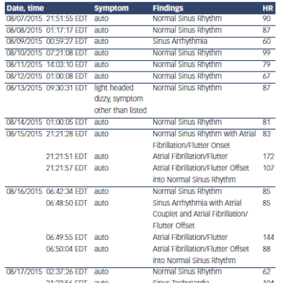 Figure 2 An Example of the Lack of Symptom–Arrhythmia Correlation on Event Monitoring