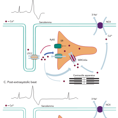 Figure 2 Mechanism of Post-extrasystolic Potentiation