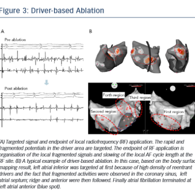 Figure 3 Driver-based Ablation