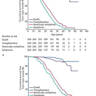 Arrhythmogenic Right Ventricular ARVD/C