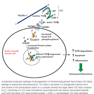 Figure 1 A Potential Molecular Pathway of Dysregulation of Transforming Growth Factor-beta Leading to Aneurysms and Dissections