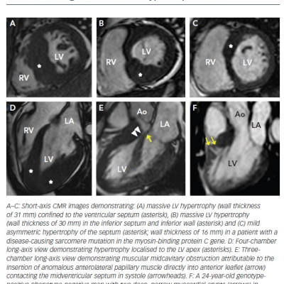 figure -1-cardiovascular-magnetic-resonance-0