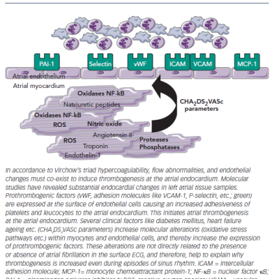 Figure 1 The Concept of ‘Endocardial Remodelling’ in Fibrillating Atria