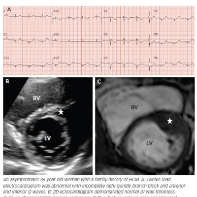 figure -2-cardiovascular-magnetic-resonance-for-0