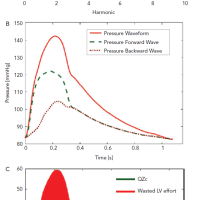 Figure 3 Assessment of Arterial Load and Ventricular– Arterial Interactions with Pressure–Flow Relations