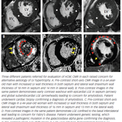 figure -3-cardiovascular-magnetic-res-for-differ