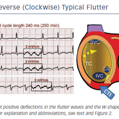 Figure 3 Reverse Clockwise Typical Flutter