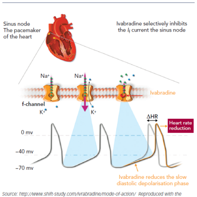 Figure 1 Mechanism of Action of Ivabradine