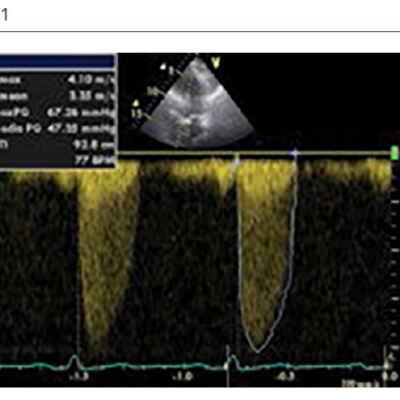 Figure1