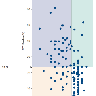 Figure 1 A Dot Plot Representation of the Relationship between PVC Burden and Ejection Fraction in 174 Patients Referred for PVC Catheter Ablation