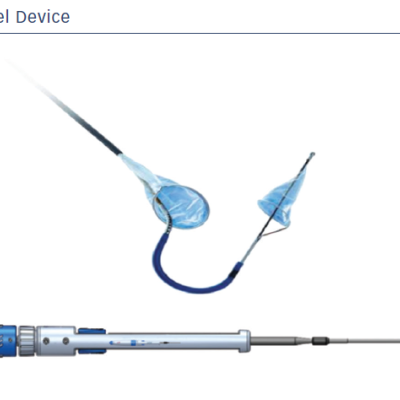 figure 1-an-example-of-the-sentinel-device