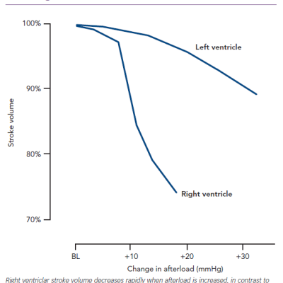 Effect of Increasing Afterload on Stroke Volume of the Right and Left Ventricles