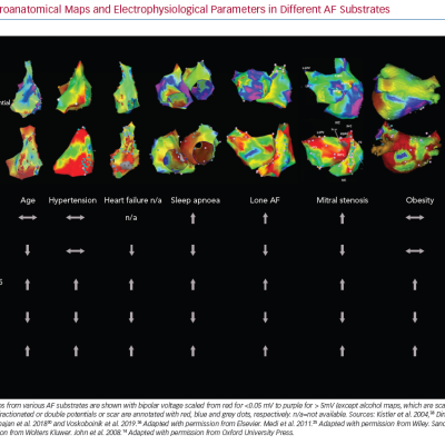 Electroanatomical Maps and Electrophysiological Parameters