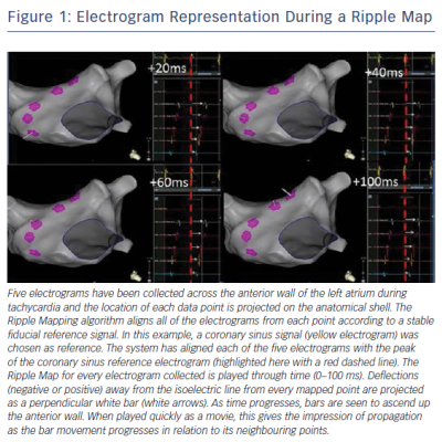 Electrogram Representation During a Ripple Map