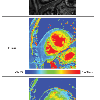 Ischaemic Cardiomyopathy Image Comparison