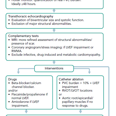 Figure 1 Management of Patients Presenting With Frequent Premature Ventricular Complexes