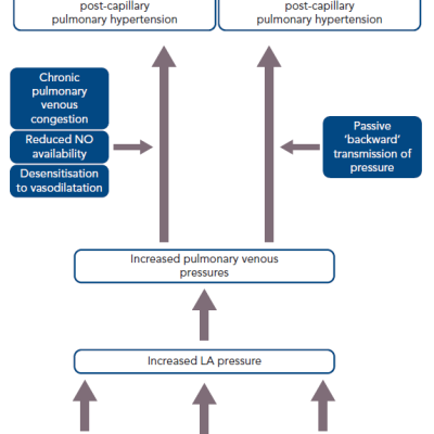 Pathophysiology of Pulmonary Hypertension in Heart Failure