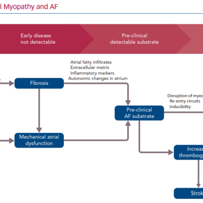 Progression of Atrial Myopathy and AF