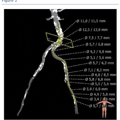 Figure2