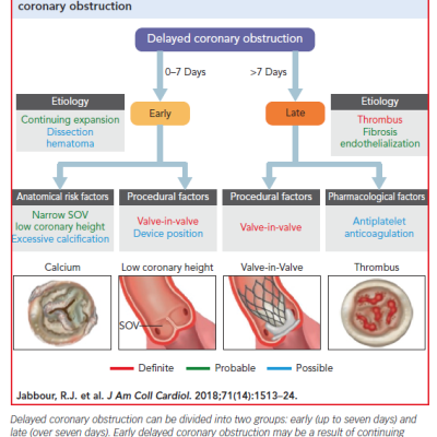 Figure 2 Aetiology and Risk Factors for Delayed Coronary Obstruction