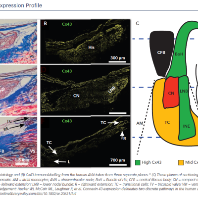 Figure 2 AVN Cx43 Expression Profile