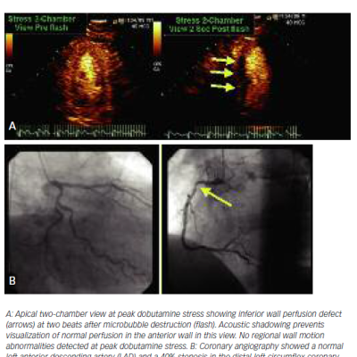 Case of a 64-year-old Male Who Underwent