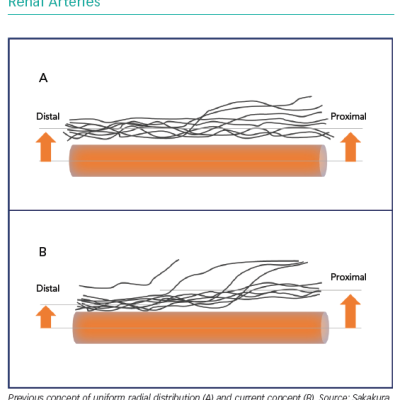 Distribution of Renal Nerves Around the Renal Arteries