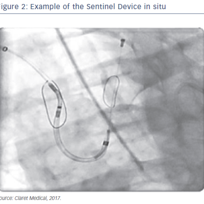 figure 2-example-of-the-sentinel