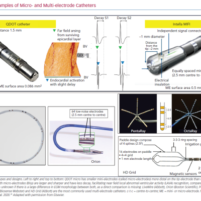 Examples of Micro- and Multi-electrode Catheters