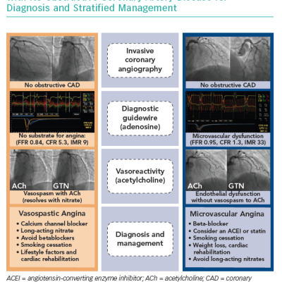 Interventional Diagnostic Procedure in Ischaemia