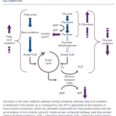 Metabolic Alterations During Sustained Period of Ischaemia