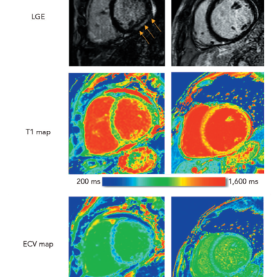 Non-ischaemic Cardiomyopathy Image Comparison