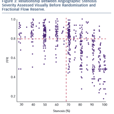 Relationship Between Angiographic Stenosis Severity Assessed visually