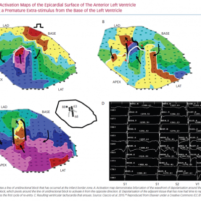 Activation Maps of the Epicardial Surface of The Anterior Left Ventricle Following a Premature Extra-stimulus from the Base of the Left Ventricle