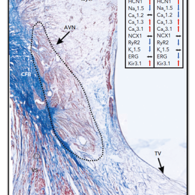 Figure 3 AVN Ion Channel Expression Profile